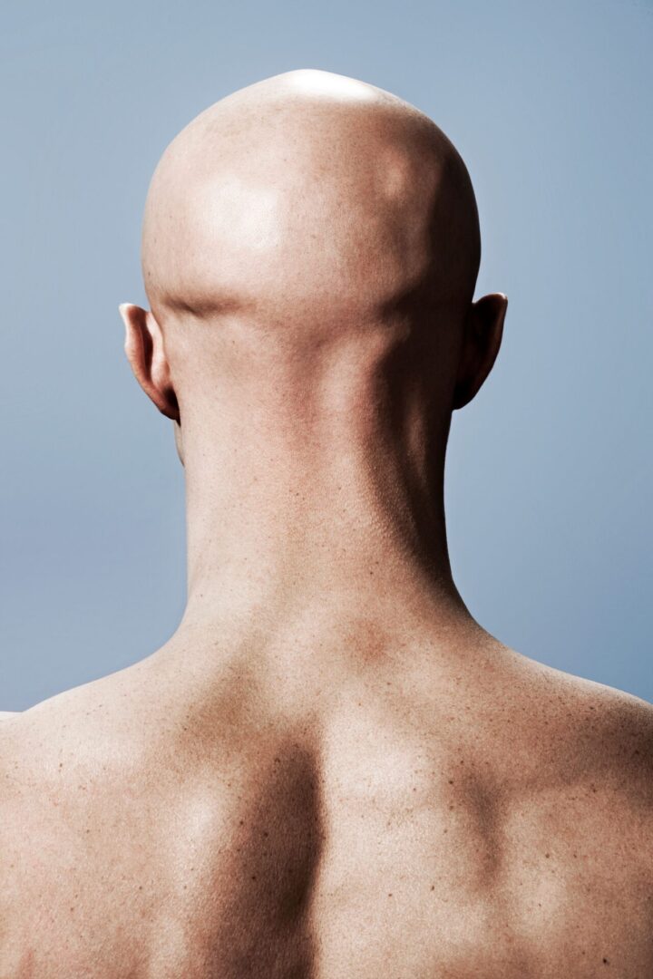The EAT upheld a decision that calling a male colleague a “bald c***” amounts to harassment relating to sex